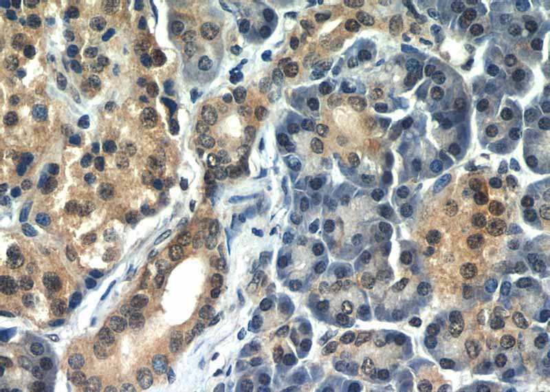 Immunohistochemical of paraffin-embedded human pancreas using Catalog No:116649(ubiquitin antibody) at dilution of 1:50 (under 40x lens)
