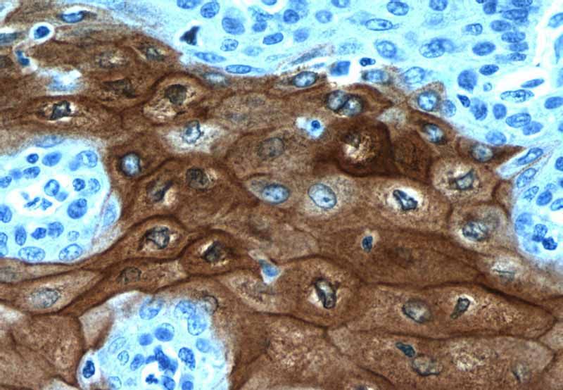 Immunohistochemistry of paraffin-embedded human oesophagus tissue slide using Catalog No:109575(CRNN Antibody) at dilution of 1:200 (under 40x lens). Heat mediated antigen retrieved with Citric acid buffer, pH6.0