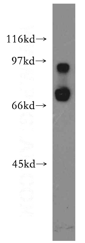 human liver tissue were subjected to SDS PAGE followed by western blot with Catalog No:111655(IL10RA antibody) at dilution of 1:400