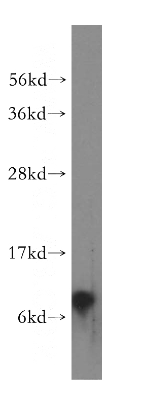 human brain tissue were subjected to SDS PAGE followed by western blot with Catalog No:113059(NDUFA3 antibody) at dilution of 1:500