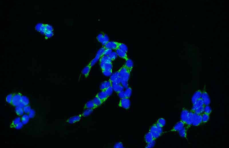 Immunofluorescent analysis of HEK-293 cells using Catalog No:113095(NEDD1 Antibody) at dilution of 1:25 and Alexa Fluor 488-congugated AffiniPure Goat Anti-Rabbit IgG(H+L)