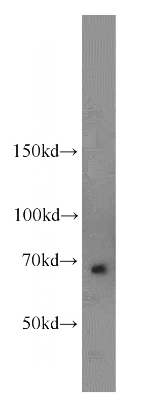mouse brain tissue were subjected to SDS PAGE followed by western blot with Catalog No:113371(NUMB antibody) at dilution of 1:800