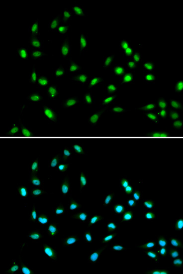 Immunofluorescence - SMARCAD1 Polyclonal Antibody 