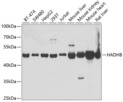 Western blot - HADHB Polyclonal Antibody 