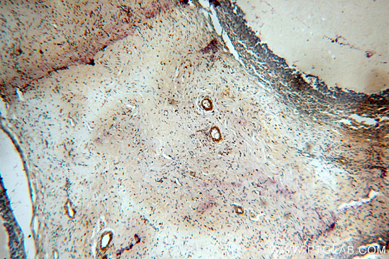 Immunohistochemical of paraffin-embedded human ovary using Catalog No:112269(LAMA4 antibody) at dilution of 1:100 (under 10x lens)