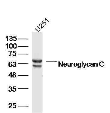 Fig1: Sample: U251 Cell (Human) Lysate at 40 ug; Primary: Anti-Neuroglycan C at 1/300 dilution; Secondary: IRDye800CW Goat Anti-Rabbit IgG at 1/20000 dilution; Predicted band size: 57 kD; Observed band size: 57/65 kD