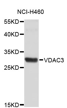 Western blot - VDAC3 Polyclonal Antibody 