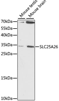 Western blot - SLC25A26 Polyclonal Antibody 