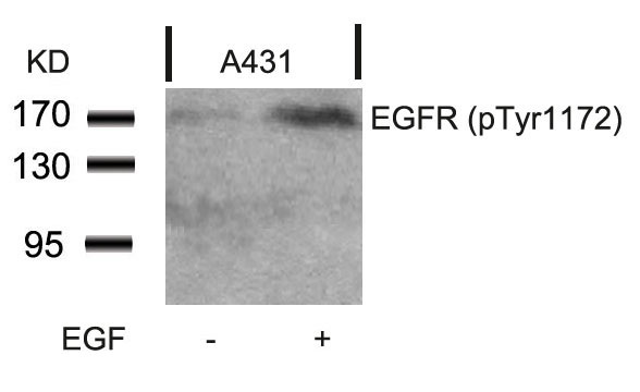Western blot analysis of extracts from A431 cells untreated or treated with EGF using EGFR (Phospho-Tyr1172) Antibody .