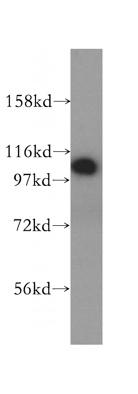 HeLa cells were subjected to SDS PAGE followed by western blot with Catalog No:114493(RABEP1 antibody) at dilution of 1:400