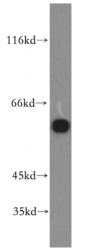 HT-1080 cells were subjected to SDS PAGE followed by western blot with Catalog No:108885(CAT-Specific antibody) at dilution of 1:1000