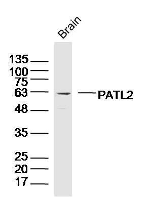 Fig2: Sample: Brain (Mouse) Lysate at 40 ug; Primary: Anti- PATL2 at 1/300 dilution; Secondary: IRDye800CW Goat Anti-Rabbit IgG at 1/20000 dilution; Predicted band size: 61 kD; Observed band size: 61 kD