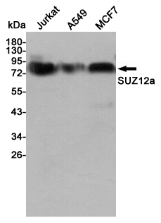Western blot detection of SUZ12 in Jurkat,A549 and MCF7 cell lysates using SUZ12 mouse mAb (1:1000 diluted).Predicted band size:83KDa.Observed band size:83KDa.