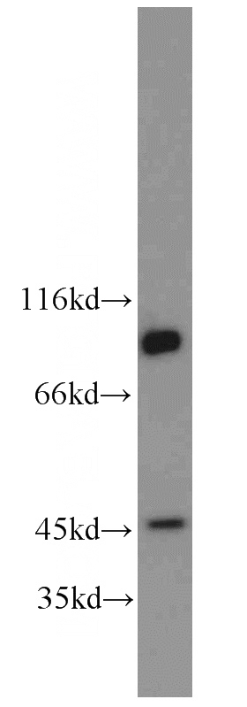 human testis tissue were subjected to SDS PAGE followed by western blot with Catalog No:113778(PGAP1 antibody) at dilution of 1:600