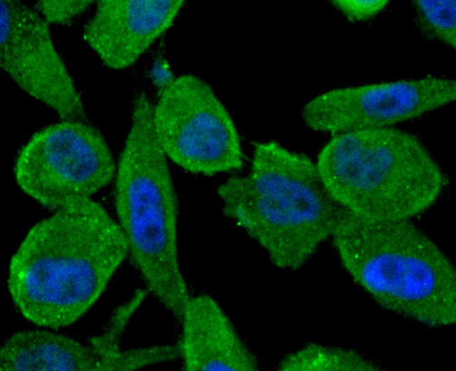 Fig3: ICC staining ABCF1 in PC-3M cells (green). The nuclear counter stain is DAPI (blue). Cells were fixed in paraformaldehyde, permeabilised with 0.25% Triton X100/PBS.