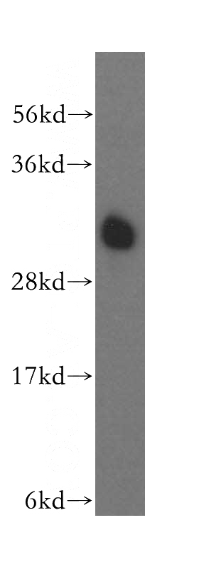 human brain tissue were subjected to SDS PAGE followed by western blot with Catalog No:108311(ATP6V1E1 antibody) at dilution of 1:500