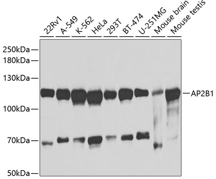 Western blot - AP2B1 Polyclonal Antibody 