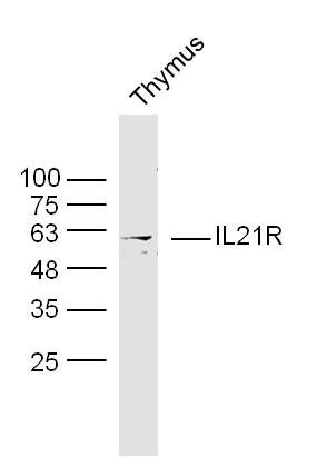 Fig2: Sample:; Thymus (Mouse) Lysate at 40 ug; Primary: Anti- IL21R at 1/300 dilution; Secondary: IRDye800CW Goat Anti-Rabbit IgG at 1/20000 dilution; Predicted band size: 55 kD; Observed band size: 55 kD