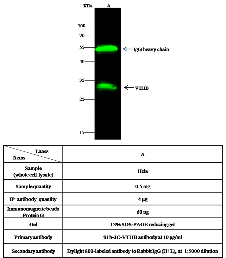 VTI1B Antibody, Rabbit PAb, Antigen Affinity Purified, Immunohistochemistry