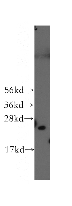 human brain tissue were subjected to SDS PAGE followed by western blot with Catalog No:114393(PSMD10 antibody) at dilution of 1:500