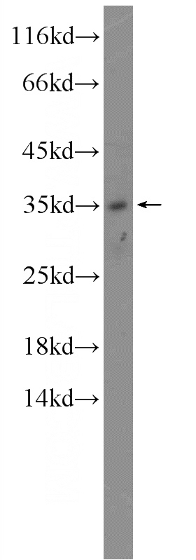 mouse brain tissue were subjected to SDS PAGE followed by western blot with Catalog No:116199(TMEM9 Antibody) at dilution of 1:300