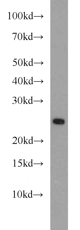 mouse spleen tissue were subjected to SDS PAGE followed by western blot with Catalog No:114405(RAB11A antibody) at dilution of 1:1000