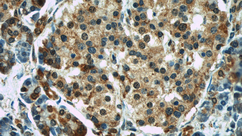 Immunohistochemistry of paraffin-embedded human pancreas slide using Catalog No:110935(GEFT-Specific Antibody) at dilution of 1:100