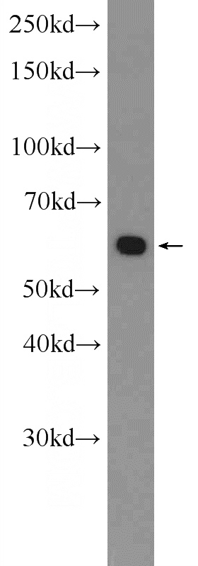 MDA-MB-453s cells were subjected to SDS PAGE followed by western blot with Catalog No:117114(Beclin 1 Antibody) at dilution of 1:1000