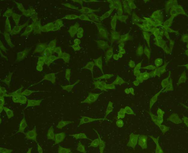 Fig4: ICC staining GAP43 in SHG-44 cells (green). Cells were fixed in paraformaldehyde, permeabilised with 0.25% Triton X100/PBS.