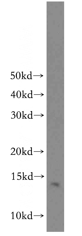 mouse brain tissue were subjected to SDS PAGE followed by western blot with Catalog No:112189(LDLRAD1 antibody) at dilution of 1:300