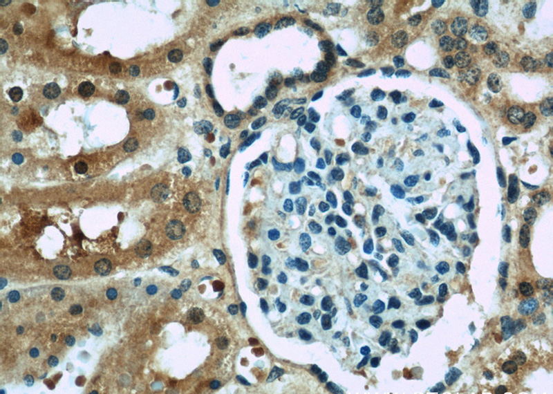 Immunohistochemistry of paraffin-embedded human kidney slide using Catalog No:107746(ACOT6 Antibody) at dilution of 1:50