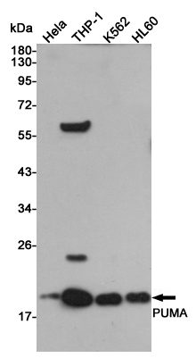 Western blot analysis of PUMA expression in Hela,THP-1,K562 and HL60 cell lysates using PUMA antibody at 1/1000 dilution.Predicted band size:18KDa.Observed band size:18KDa.