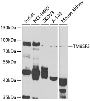 Western blot - TM9SF3 Polyclonal Antibody 