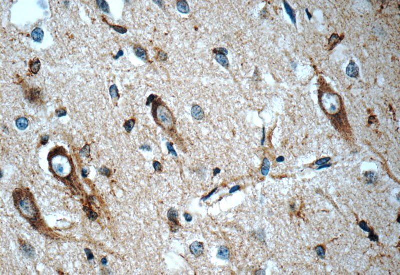 Immunohistochemistry of paraffin-embedded human brain tissue slide using Catalog No:113024(N-cadherin Antibody) at dilution of 1:50 (under 40x lens)