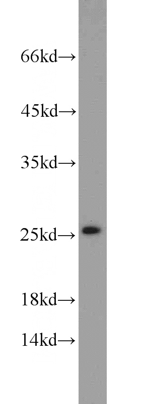mouse liver tissue were subjected to SDS PAGE followed by western blot with Catalog No:115067(SAR1B antibody) at dilution of 1:1000