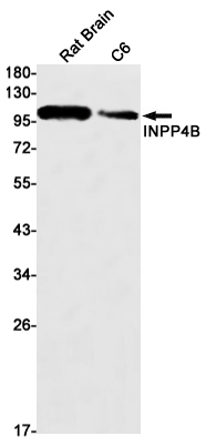 Western blot detection of INPP4B in Rat Brain,C6 cell lysates using INPP4B Rabbit mAb(1:1000 diluted).Predicted band size:105kDa.Observed band size:105kDa.