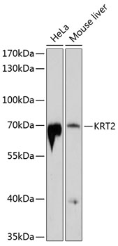 Western blot - KRT2 Polyclonal Antibody 