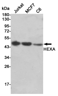 Western blot detection of HEXA in Jurkat,MCF7 and C6 cell lysates using HEXA mouse mAb (1:2000 diluted).Predicted band size:61KDa.Observed band size:50KDa.