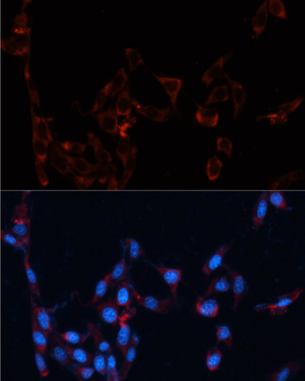 Immunofluorescence - GPC4 Polyclonal Antibody 