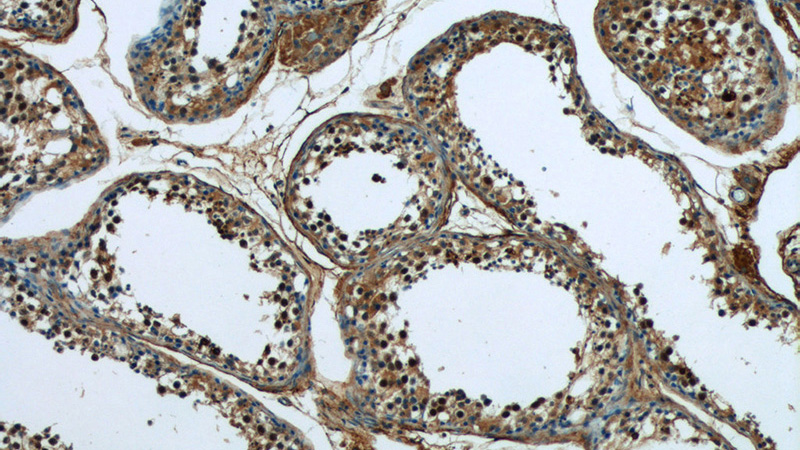 Immunohistochemistry of paraffin-embedded human testis tissue slide using Catalog No:112053(KIFC1 Antibody) at dilution of 1:50 (under 10x lens)