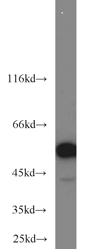PC-3 cells were subjected to SDS PAGE followed by western blot with Catalog No:110677(FKBP52 antibody) at dilution of 1:1000