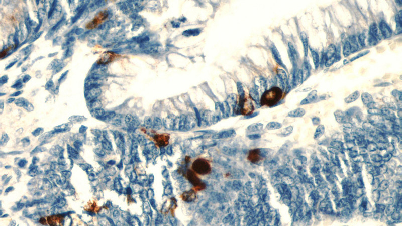 Immunohistochemical of paraffin-embedded human colon using Catalog No:109288(CHGA antibody) at dilution of 1:800 (under 40x lens)