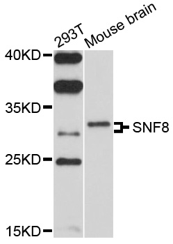 Western blot - SNF8 Polyclonal Antibody 