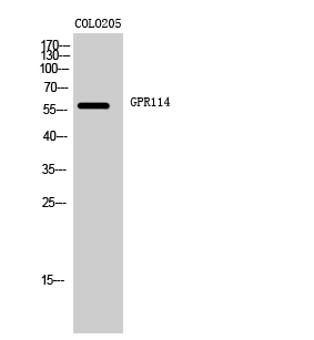 Fig1:; Western Blot analysis of COLO205 cells using GPR114 Polyclonal Antibody