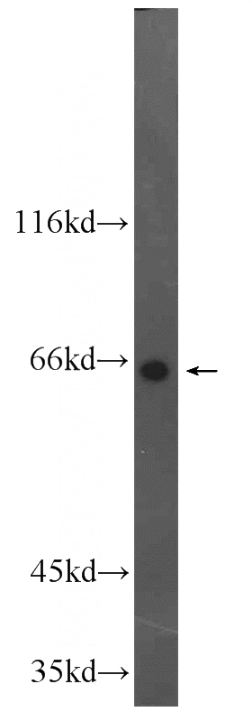 HepG2 cells were subjected to SDS PAGE followed by western blot with Catalog No:109839(DDX56 Antibody) at dilution of 1:1000