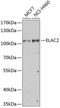 Western blot - ELAC2 Polyclonal Antibody 