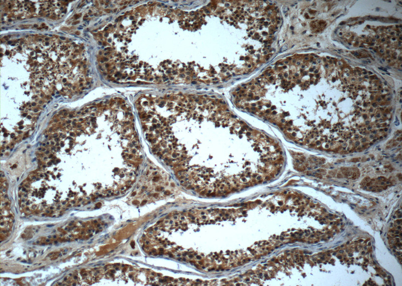 Immunohistochemistry of paraffin-embedded human testis slide using Catalog No:111668(C14orf179 Antibody) at dilution of 1:50 (under 10x lens)