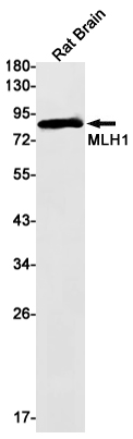 Western blot detection of MLH1 in Rat Brain lysates using MLH1 Rabbit mAb(1:1000 diluted).Predicted band size:85kDa.Observed band size:85kDa.