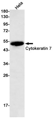 Western blot detection of Cytokeratin 7 in Hela cell lysates using Cytokeratin 7 Rabbit mAb(1:500 diluted).Predicted band size:51kDa.Observed band size:51kDa.