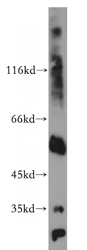 human testis tissue were subjected to SDS PAGE followed by western blot with Catalog No:116620(UNG antibody) at dilution of 1:300